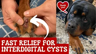 Fast Relief For Interdigital Cysts