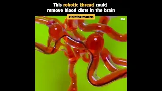 Revolutionizing Brain Surgery: Meet the World's Thinnest Robot!