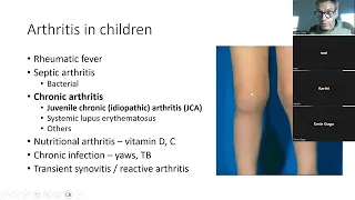 2024 15 Arthritis in children