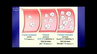 Как Снизить ВЫСОКИЙ САХАР в Крови в ДОМАШНИХ условиях / ГИПЕРГЛИКЕМИЯ / Профилактика / Фролов Ю.А.