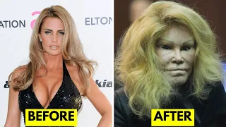 25 Celebrities Before and After Plastic Surgery