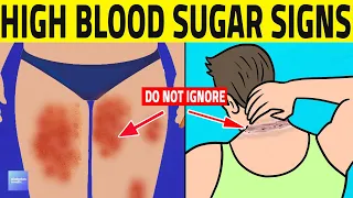 Top 7 Prediabetes Signs You Shouldn't Ignore!