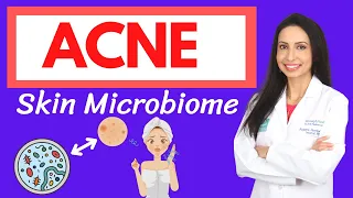 ACNE and the Skin Microbiome:  A Holistic Approach to Healing Your Acne from the Inside Out
