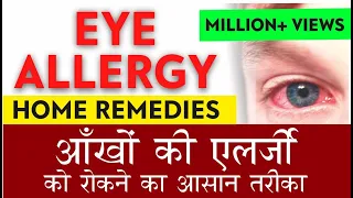 Home Remedies for Eye Allergy | Best treatment for Eye Allergy |आँखो की एलर्जी का सही और आसान इलाज |