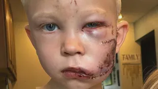 6-Year-Old Saves Younger Sister From Dog Attack