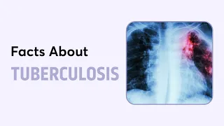 Facts about Tuberculosis | World Tuberculosis Day | Diseases Decoded | PrepLadder