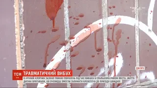 8-річному хлопчику відірвало кисть руки під час вибуху у Дніпрі