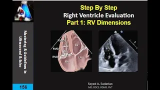 Step By Step: RV evaluation part 1:  measurements