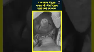 Rajasthan Dausa News | Child born with Lord Ganesha Face | Viral Video | #shorts