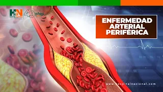 ENFERMEDAD ARTERIAL PERIFÉRICA