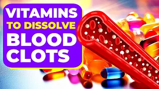 6 Amazing Vitamins To Dissolve Blood Clots FAST