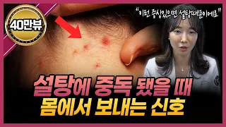 당신이 설탕을 너무 많이 섭취하고 있다는 8가지 징후