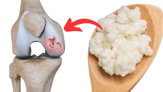 FOOD FOR THE RENEWAL OF KNEE CARTILAGE