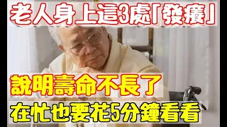 老人身上這3處「發癢」，說明壽命不長了！如果你一個都不佔，活到100歲沒問題！|養生之家