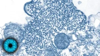 Nipah - Das gefährlichste Virus der Welt breitet sich in Indien aus - Clixoom Science & Fiction