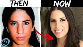 Top 10 Influencers Who Used To Look Totally Different