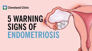 5 Warning Signs of Endometriosis