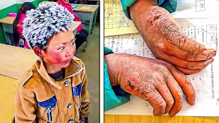 8-year-old Comes to School With a FROZEN Head, Teacher Looks Closer And His Heart Breaks