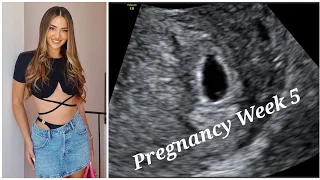 Luiz Ejlli -Kiara Tito është shtatzënë.