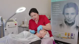Что такое PRP терапия? Реальное видео из кабинета косметолога!