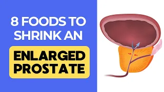 Top 8 Foods To Shrink An Enlarged Prostate