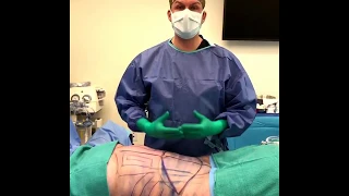 Visage Clinic's Dr. Marc DuPéré Live Surgery: Tummy Tuck (Abdominoplasty) with Liposuction