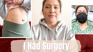 My Gallbladder Removal Surgery Experience Vlog | Full week of recovery + my scars | Cholecystectomy