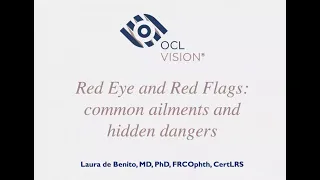 Red Eye : Differential Diagnosis & Management