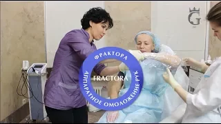 Омоложение рук с помощью насадки FRACTORA