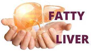 Natural Approaches to Fatty Liver