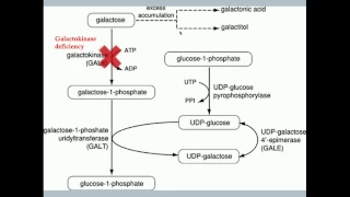 Disorders of Fructose and Galactose Metabolism - CRASH! Medical Review Series