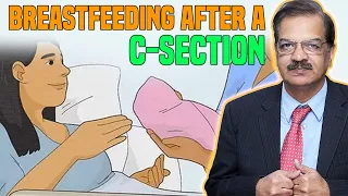 Breastfeeding After a C-Section ?? Dr Naeem Zafar