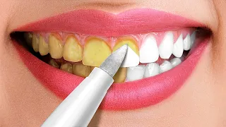 30 Amazing Hacks For A White Smile || Beauty Tricks and Tips