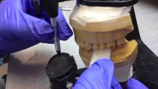 Occlusion Laboratory Video Guides Video 9 Selective Grinding