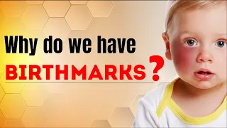 Why do we have Birthmarks? | Science Curiosity | Letstute