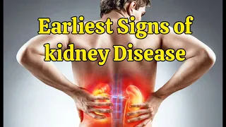 What are the Early Signs of Kidney Disease? Earliest Signs of kidney Disease | Health is Wealth 458
