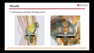 [Webcast] - Contact Forces and Kinematics of Total Knee Arthroplasty During Squatting