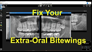 CSI 8 - Fix Your Extraoral Bitewings