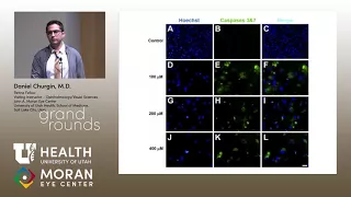 Proliferative Vitreoretinopathy