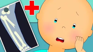 Caillou Breaks a Bone | Caillou Compilations