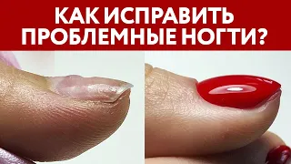 Клиент с проблемными ногтями! Что делать? | Онихолизис, трапециевидная форма ногтей, ногти трамплин