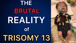 The BRUTAL Reality of Having a Trisomy Child (Trisomy 13 & 18) (13トリソミー)