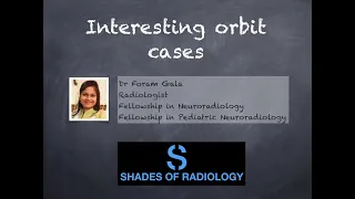Interesting orbit cases by Dr Foram Gala