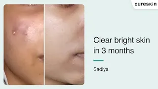 Clear bright skin in 3 months | Cureskin