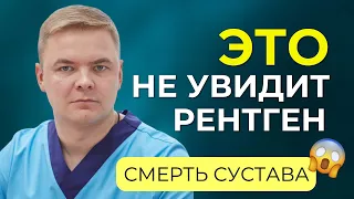 Асептический некроз или смерть сустава. Как заподозрить и не допустить? Можно ли вылечить?