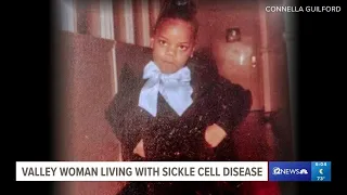 Gilbert mom living with sickle cell disease beats the odds