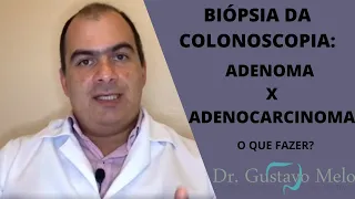 Biópsia da colonoscopia: Adenoma x Adenocarcinoma.
