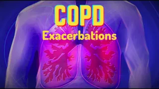 COPD Exacerbations (updated 2023) - CRASH! Medical Review Series