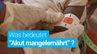 Was bedeutet es, wenn Kinder "akut mangelernährt" sind? | Definition und Fakten