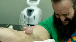 Braun Strowman's elbow surgery and harrowing rehab: Remaking The Monster - Episode 1